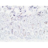 Ret Polyclonal Antibody