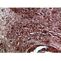 Ret Polyclonal Antibody