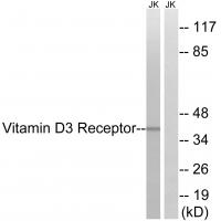 VDR Polyclonal Antibody