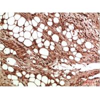 VEGF Rabbit Polyclonal Antibody