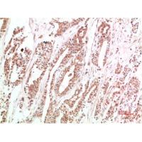 VEGF Rabbit Polyclonal Antibody