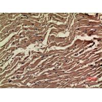 VEGF-A Polyclonal Antibody