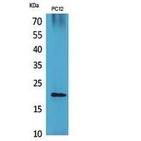 VEGF-B Polyclonal Antibody