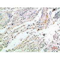 Versican Polyclonal Antibody