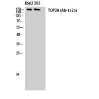 Topo IIα Polyclonal Antibody