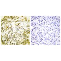 Topo IIα Polyclonal Antibody