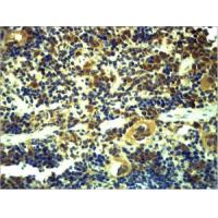 TLR6 Polyclonal Antibody