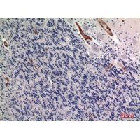 TNAP Polyclonal Antibody