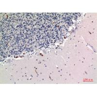 TNAP Polyclonal Antibody