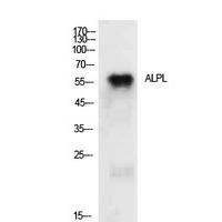 TNAP Polyclonal Antibody