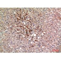 TNAP Polyclonal Antibody