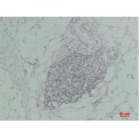 TNF α Polyclonal Antibody