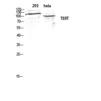 TERT Polyclonal Antibody