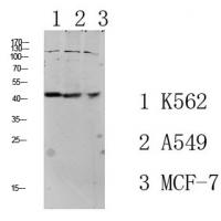 TGF β1 Polyclonal Antibody