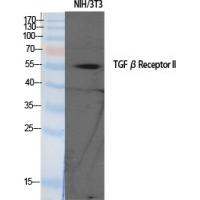 TGFβ RII Polyclonal Antibody