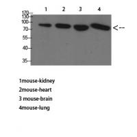 TGFβ RIII Polyclonal Antibody