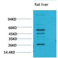 TGFβ1 Polyclonal Antibody