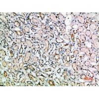 TGFβ3 Polyclonal Antibody