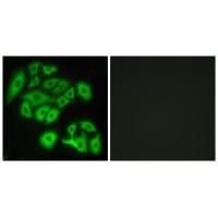 Frizzled-4 Polyclonal Antibody