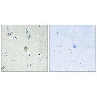 Frizzled-5/8 Polyclonal Antibody