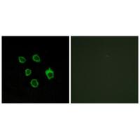 Frizzled-5/8 Polyclonal Antibody