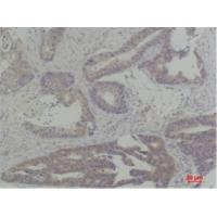 TBP Polyclonal Antibody