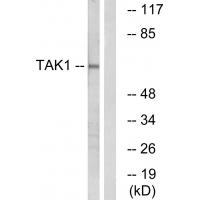 Tak1 Polyclonal Antibody