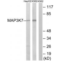 Tak1 Polyclonal Antibody