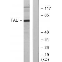 Tau Polyclonal Antibody