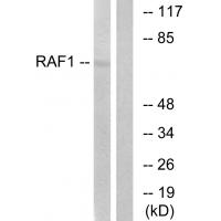 Raf-1 Polyclonal Antibody