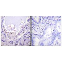 Raf-1 Polyclonal Antibody