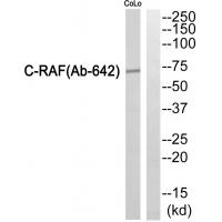 Raf-1 Polyclonal Antibody