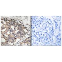 Raf-B Polyclonal Antibody