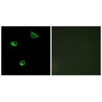 Frizzled-6 Polyclonal Antibody