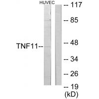 RANKL Polyclonal Antibody