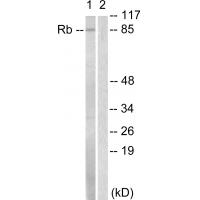 Rb Polyclonal Antibody