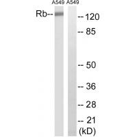 Rb Polyclonal Antibody