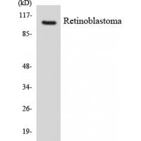 Rb Polyclonal Antibody