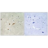 Rac GAP1 Polyclonal Antibody