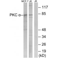 PKC α Polyclonal Antibody