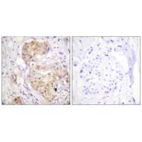 PKC δ Polyclonal Antibody