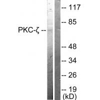 PKC ζ Polyclonal Antibody