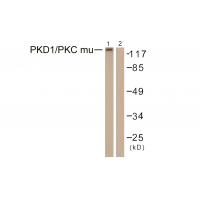 PKD1 Polyclonal Antibody