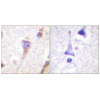 PKD1 Polyclonal Antibody