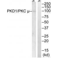 PKD1 Polyclonal Antibody