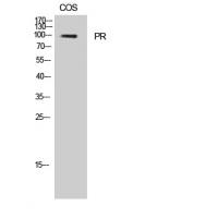 PR Polyclonal Antibody