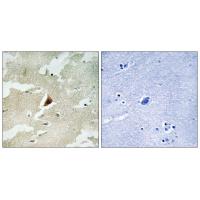 PRAK Polyclonal Antibody