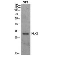 PSA Polyclonal Antibody