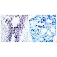 PTEN Polyclonal Antibody