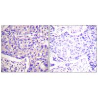 PTEN Polyclonal Antibody